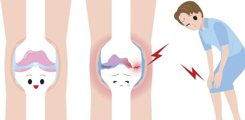 【物理自療】你了解「痛」嗎？